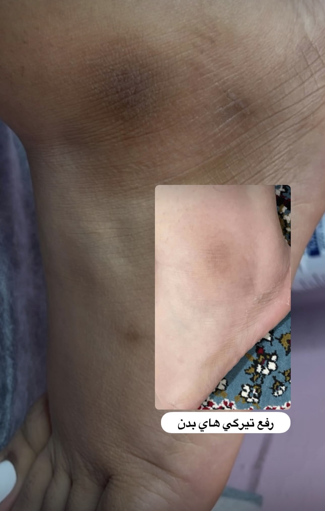 Mastering the First Impression: Your intriguing post title goes here پاکسازی بدن