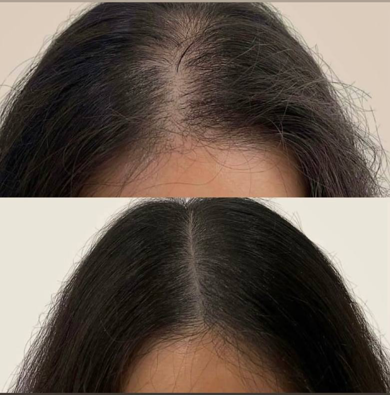 Crafting Captivating Headlines: Your awesome post title goes here میکرواسکالپ