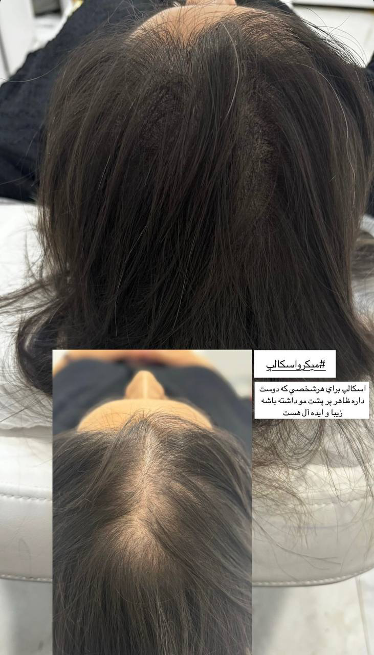 The Art of Drawing Readers In: Your attractive post title goes here میکرواسکالپ